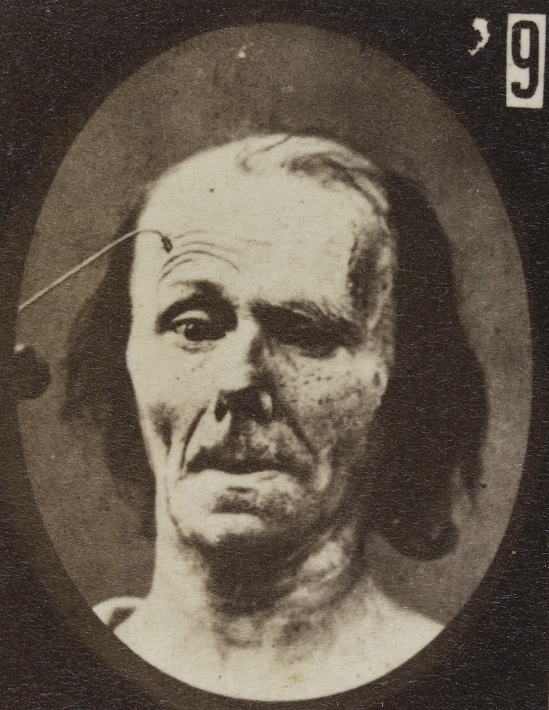 Illustration for article titled Terrifying, Century-Old Photographs from Neuroscience Experiments
